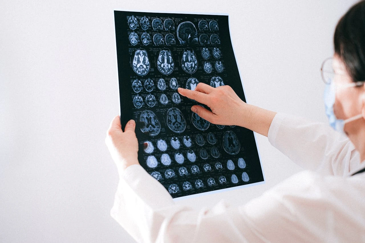 Jak psychodeliki wpływają na mózg? Kluczowe mechanizmy działania